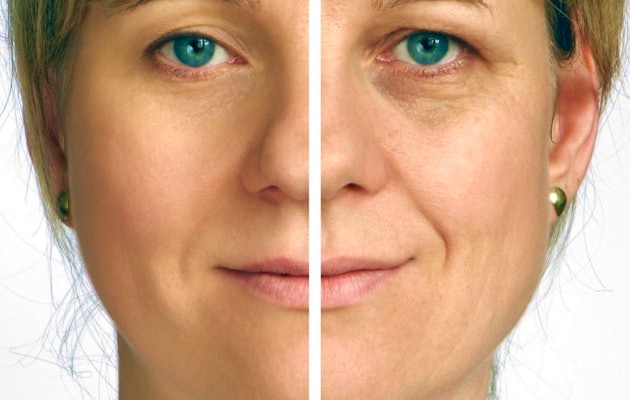 Laser Facelift; 5 gelaats- en halsbehandelingen door Perfect You Skin Clinic!